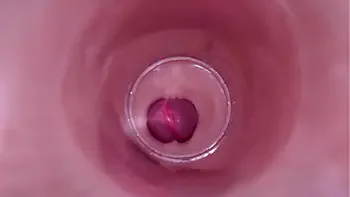 Female Insemination - Internal Camera Captures Deep Male Ejaculation
