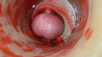 Camera Inside Deep Pussy Captures Dose Ejaculation of Sperm ASMR