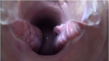 Mature Lesbians Play In A Gynecologist, Open The Vagina With A Medical Dilator, Examine The Cervix